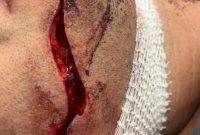 مقاومت دستفروشان خیابان تربیت در انتقال به سه راه امین/بریده شدن گوش مغازه دار خیابان تربیت توسط یک دستفروش مقاومت دستفروشان خیابان تربیت در انتقال به سه راه امین/بریده شدن گوش مغازه دار خیابان تربیت توسط یک دستفروش