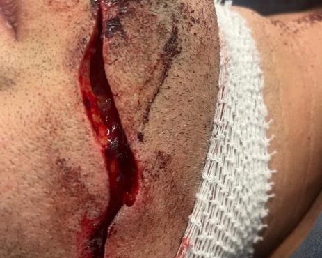 مقاومت دستفروشان خیابان تربیت در انتقال به سه راه امین/بریده شدن گوش مغازه دار خیابان تربیت توسط یک دستفروش